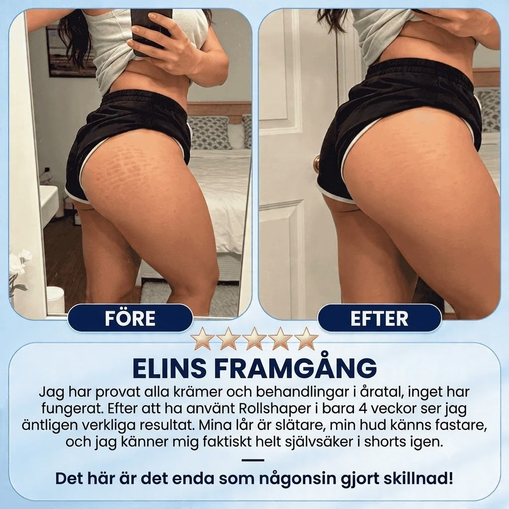 Glättrol | Anti-Cellulit Massagerulle