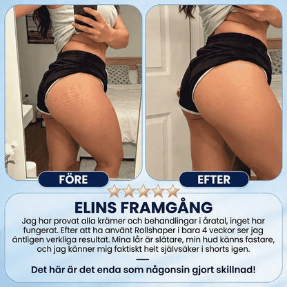 Glättrol | Anti-Cellulit Massagerulle