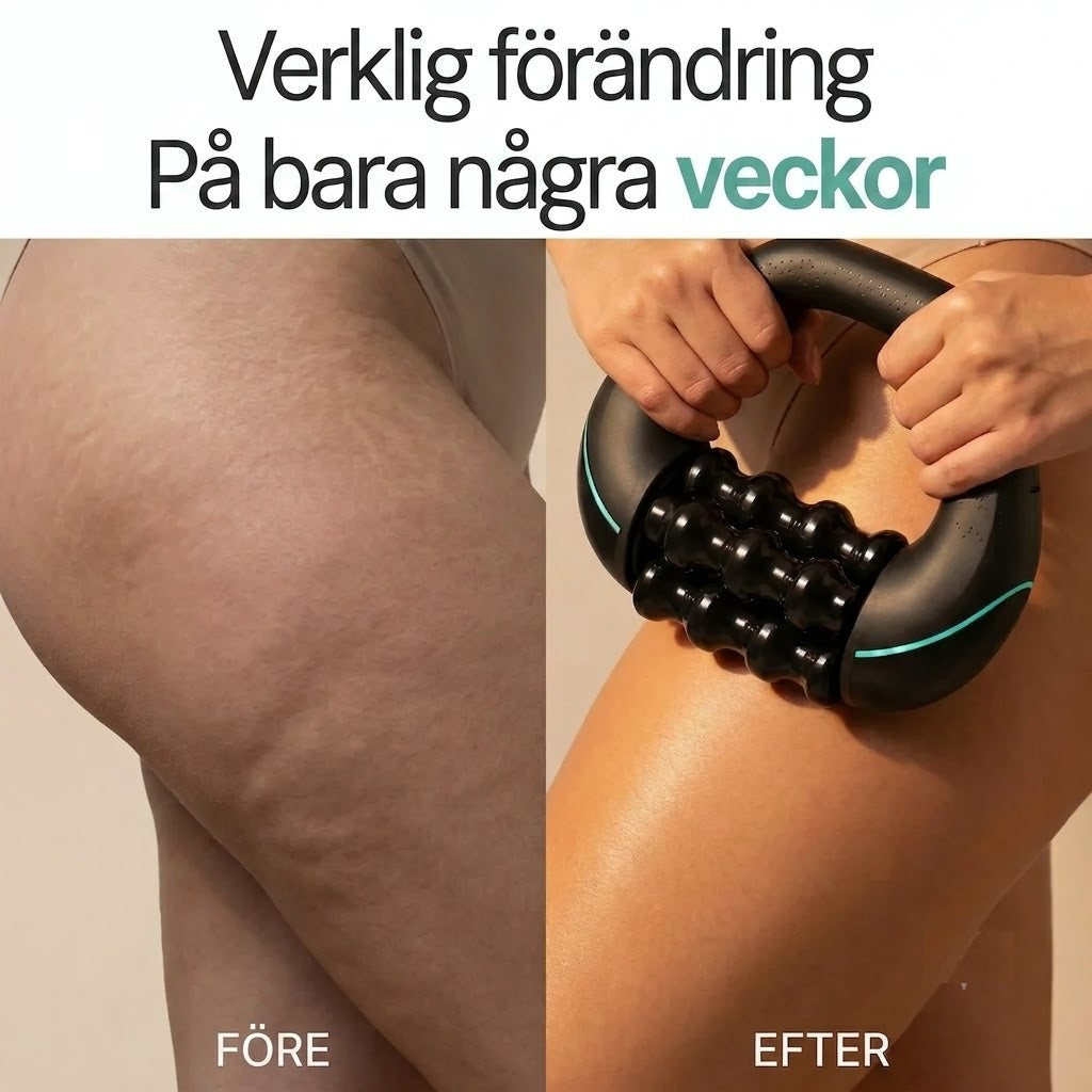 Glättrol | Anti-Cellulit Massagerulle