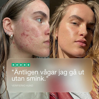 Clear+| 100 % naturligt stöd för hud som är benägen att få finnar.