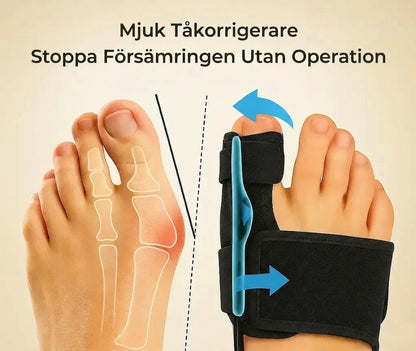 Mjuk tåkorrigerare (vänster + höger) – och hur du stoppar det utan operation